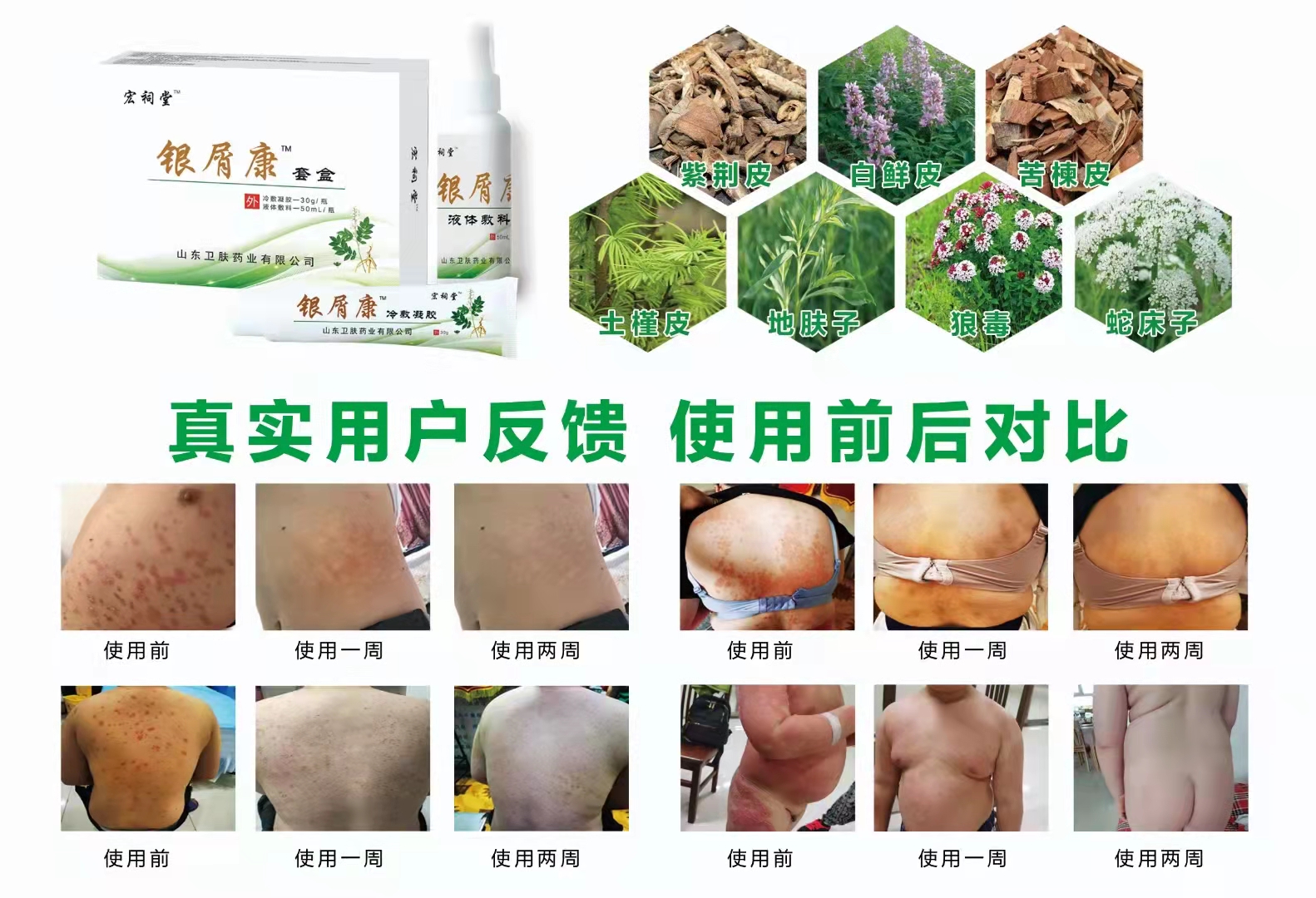 宏祠堂銀屑康套盒1.jpg