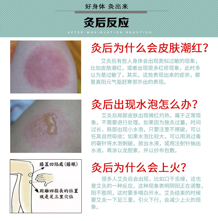 艾條 溫灸艾條 艾段艾條 廠家批發艾草陳純艾醫用艾灸條柱保健