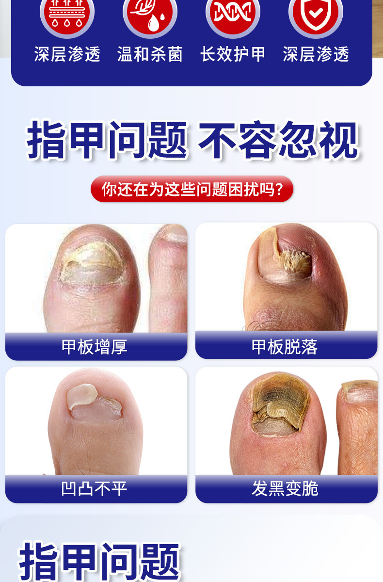 國藥世家灰甲貼修復貼護理腳趾甲軟甲嵌甲增厚型亮甲溝修護貼