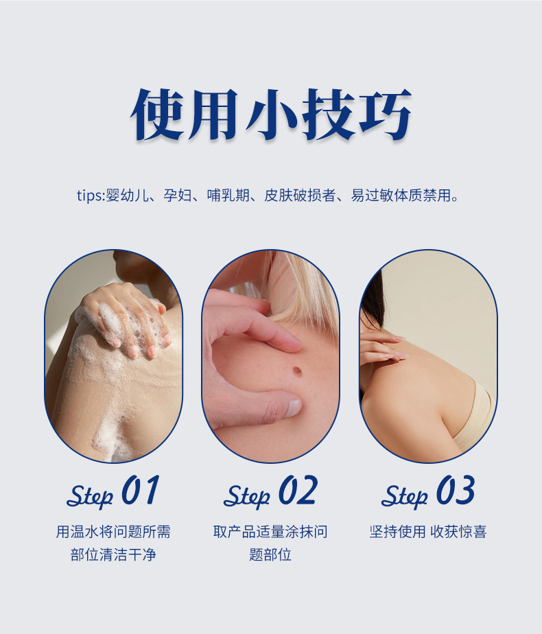 安井川雞繭尤膏手腳老繭腳墊死皮肉刺跖疣雞眼膏足部護理膏瘊疣膏