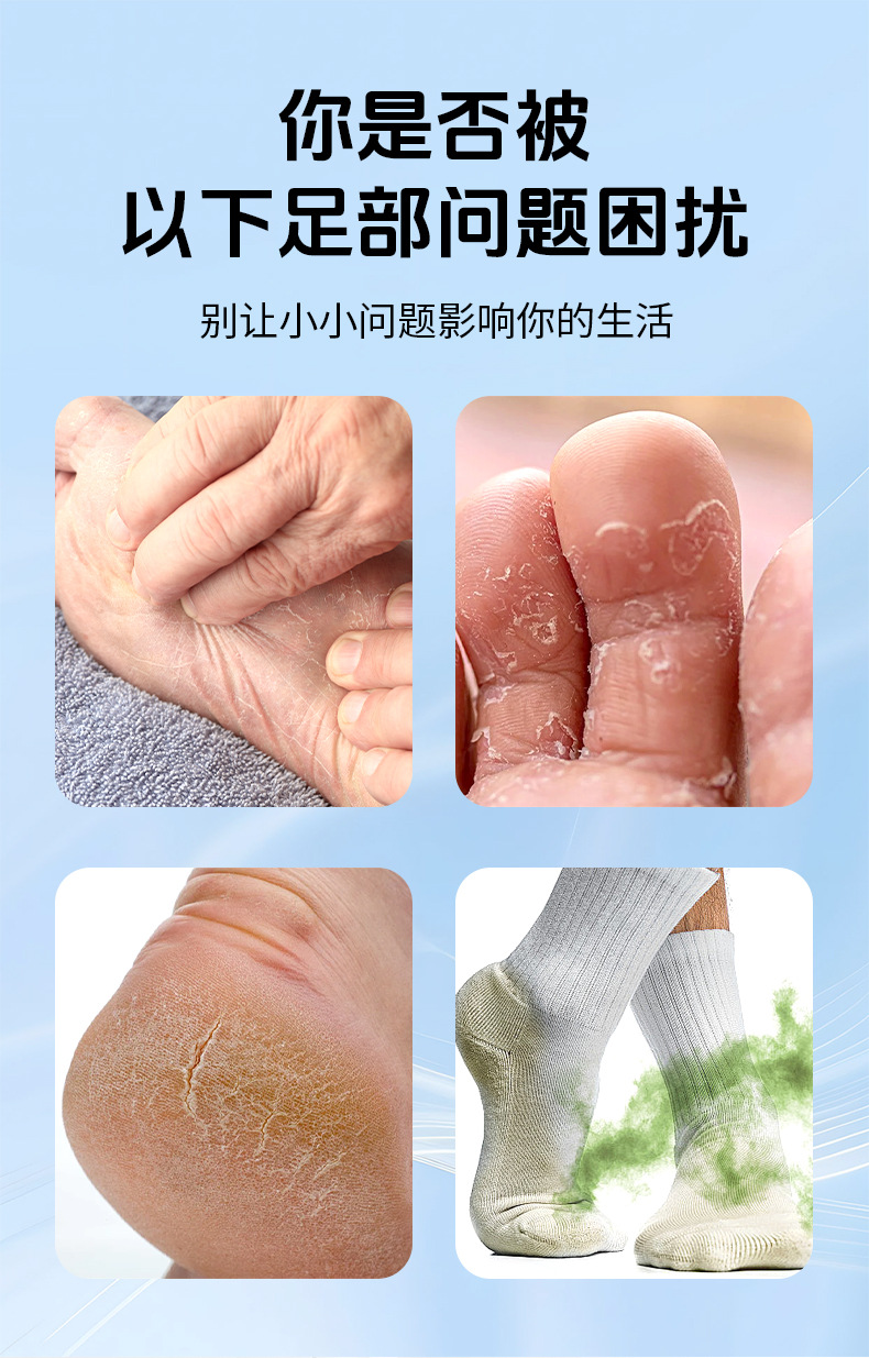 苗家郎中腳臭噴劑廠家批發(fā)腳臭腳汗噴霧腳丫噴劑止汗脫皮苗藥乳膏