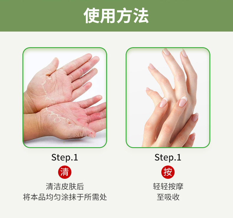 雪槐手足脫皮鄆裂膏手腳干裂脫皮腳后跟裂口滋潤皮膚乳膏源頭工廠