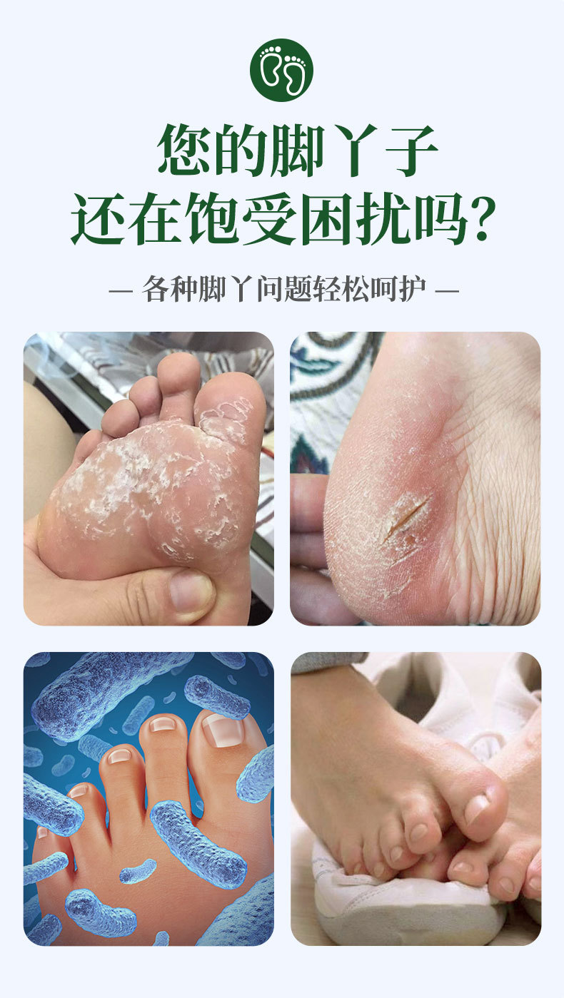 云南本草狼毒膏廠家批發(fā)腳汗腳癢腳臭乳膏足部護(hù)理止癢膏代發(fā)抑菌