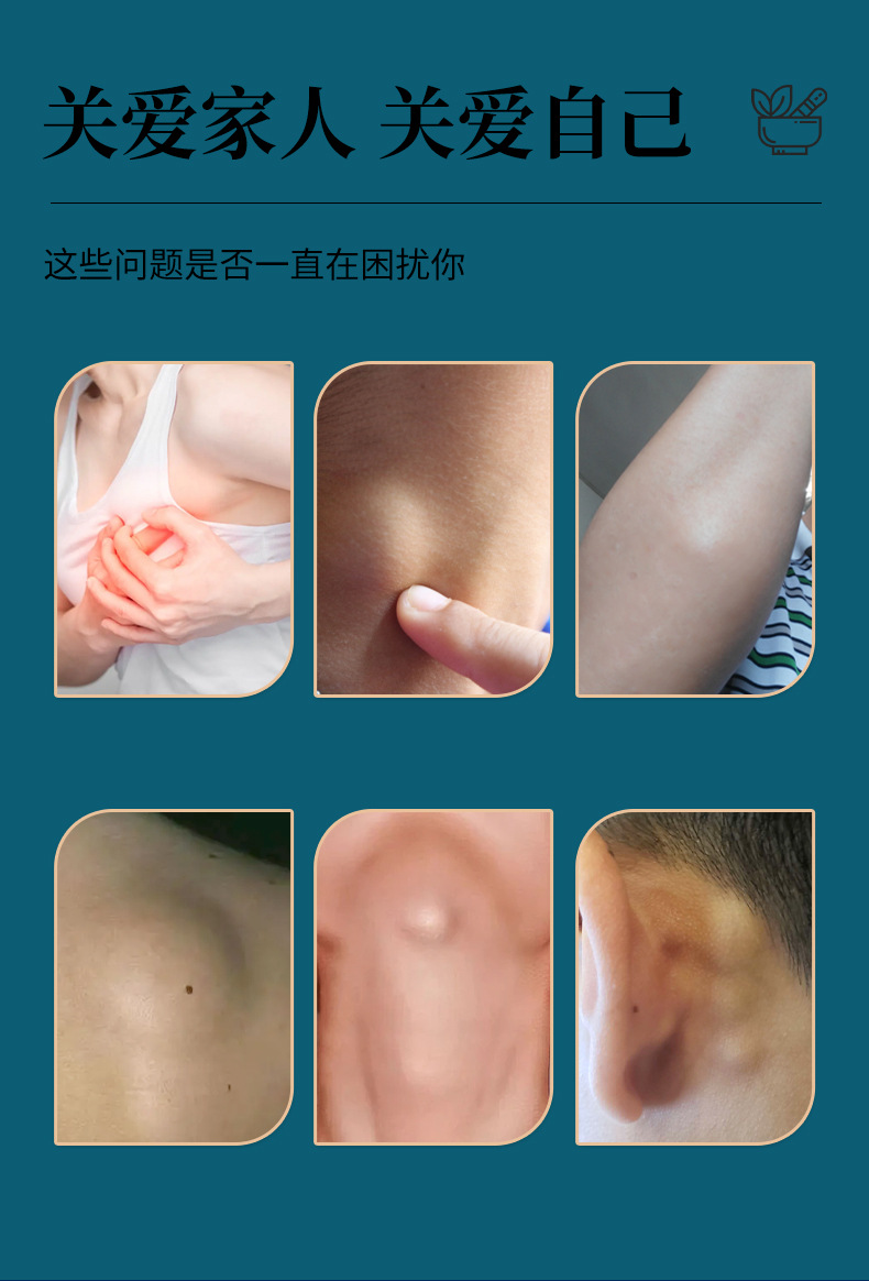 云南本草結(jié)節(jié)泡腳凝珠濃縮免熬煮熏蒸足浴原液二十八味泡腳包藥浴
