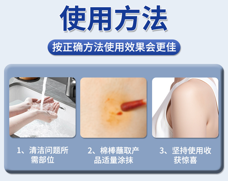雪槐繭尤清肉刺腳墊瘊子雞眼2024新品 克疣液老繭死皮草本抑菌液