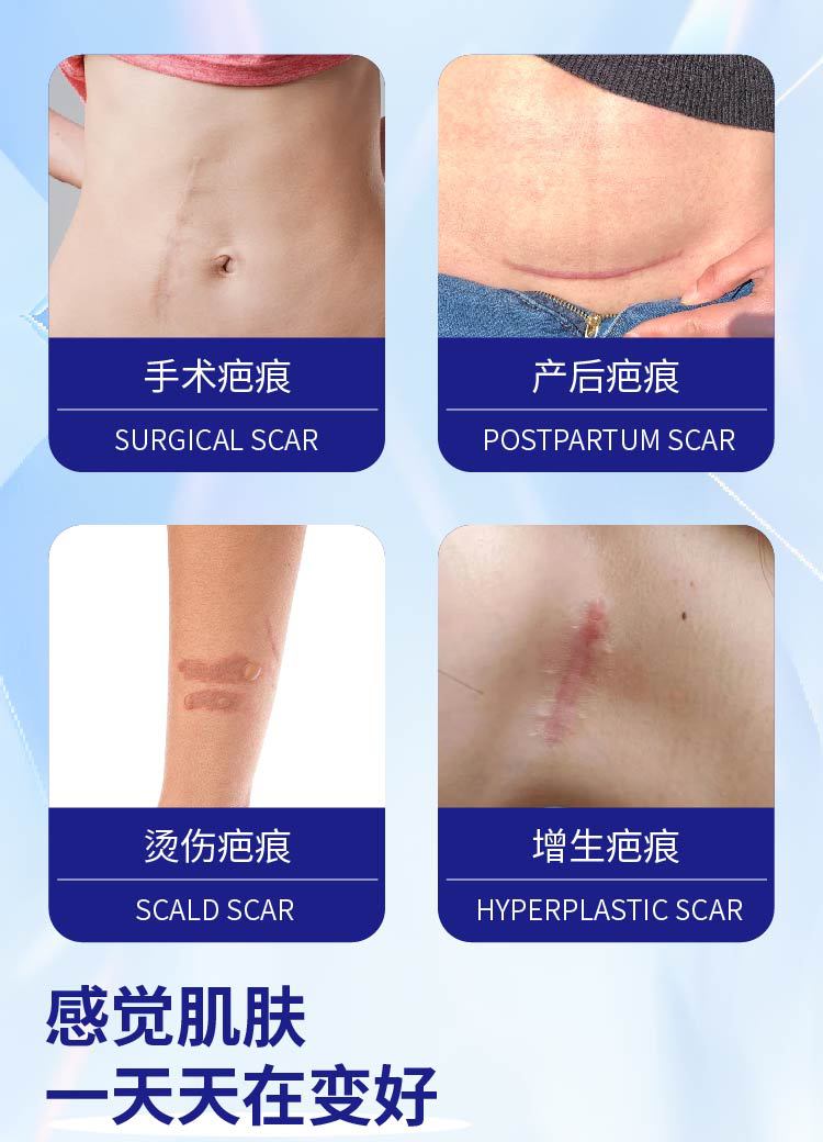 疤紋無痕膏滾珠凝膠疤痕增生手術疤腿疤淡緩解舒緩產后疤批發定制