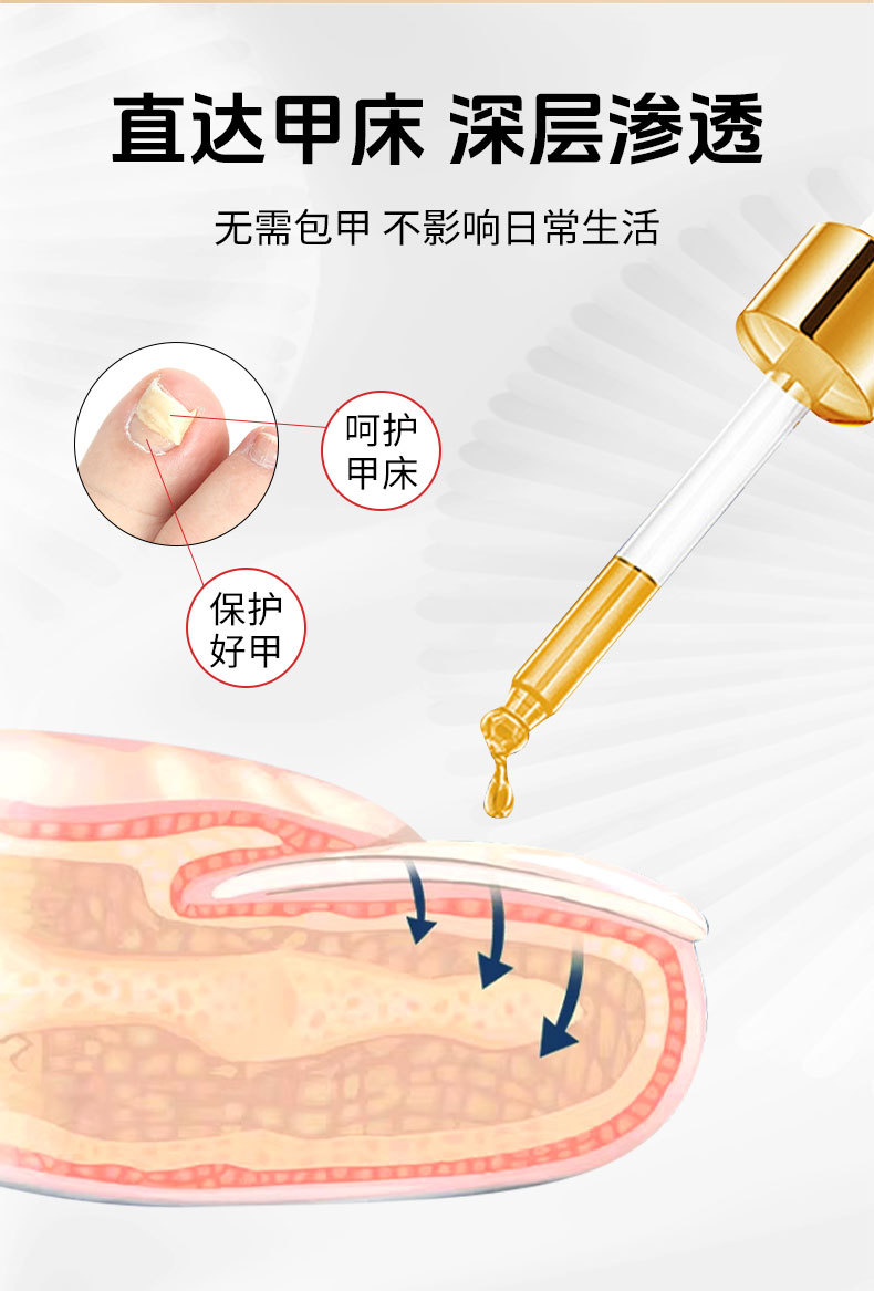 同仁堂灰甲寧滴劑鳳仙花足部護理脫甲精油灰指甲去甲膏藥水和甲膏