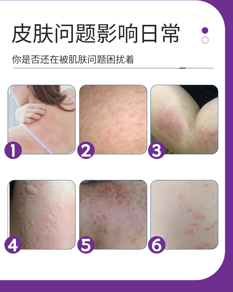 同仁堂紫花地丁膏皮膚外用草本涂抹乳膏紫草膏全家通用止癢紫金膏