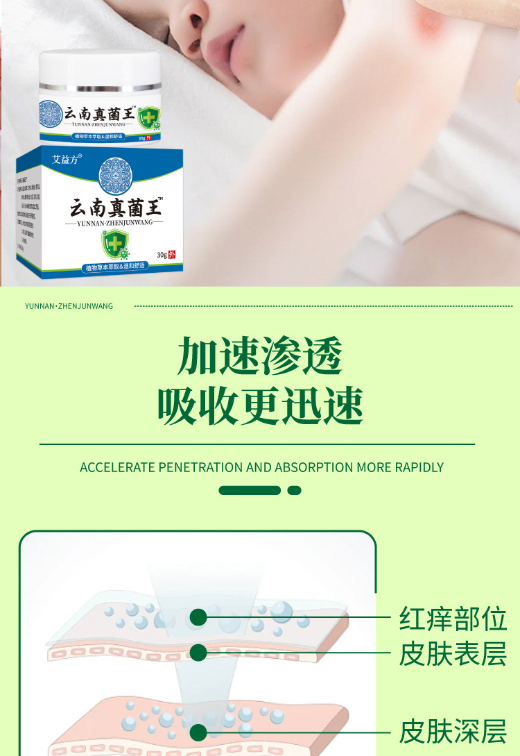 云南真菌王手指起皮粗干裂起硬皮腳后跟防裂膏斷癢王皮膚瘙癢批發