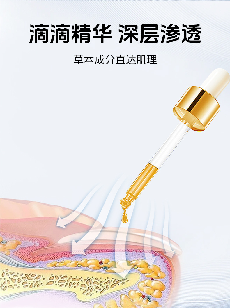 灰甲寧灰指甲抑菌液代發鳳仙花足部護理脫甲精油去甲膏廠家批發