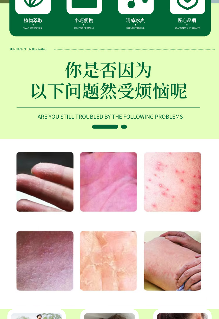 云南真菌王手指起皮粗干裂起硬皮腳后跟防裂膏斷癢王皮膚瘙癢批發